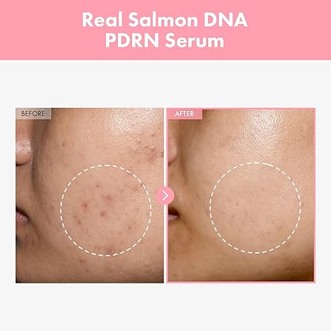 Nicotinamide Moisturizing The Lifting Face Serum Deep Hydrating And Firming Brightening Skin Color Lock Moisture Relieve Dry Fading Spots
