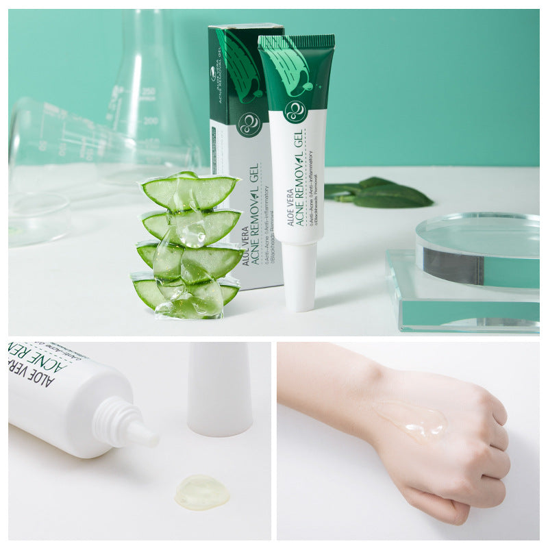 Aloe Acne Care Gel - Soothing Face Cream Serum Pore Minimizer