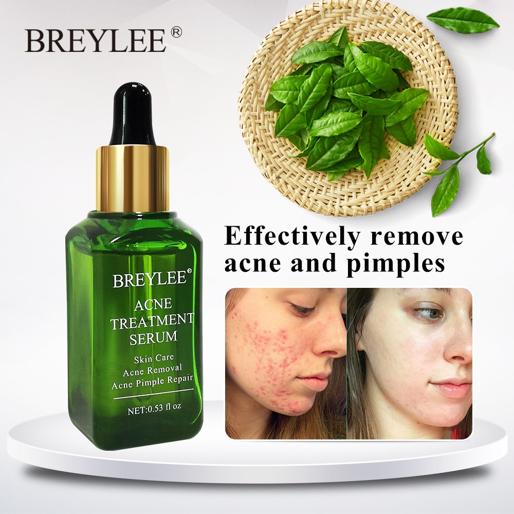 BREYLEE Acne Care Serum - Anti Acne Scar Removal Cream Skin Whitening