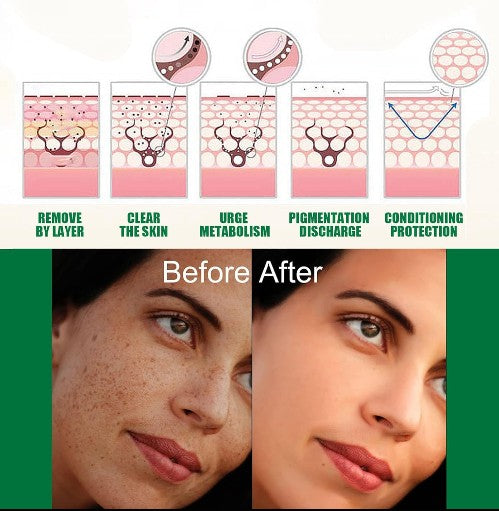 Eelhoe - Dark Spot Correcting Serum