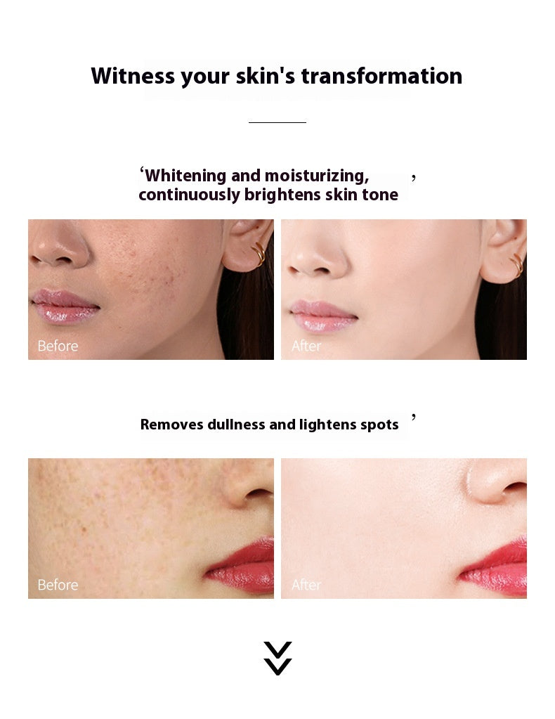 Moisturizing Hydrating Whitening Freckle Cream