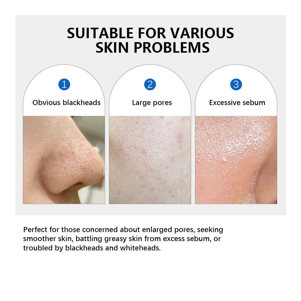 Korean Zero Pore Pad 2.0 - Exfoliating Toner Pads (70pcs)